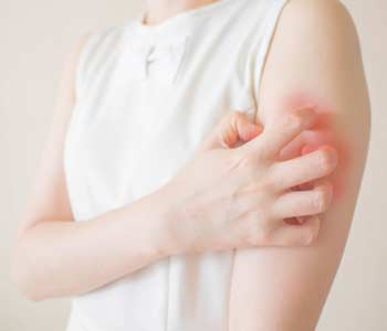 When to See Your Dermatologist for Psoriasis in Alexandria, VA area